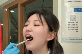 青海女牙医自己打麻药拔智齿，被网友称雄鹰般的女人：其他医生拔也是拔图片
