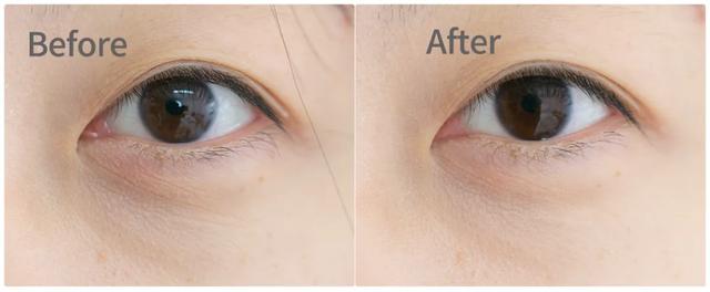 真爱大牌捡漏 | 火了100年的奥伦纳素	，这次破价100+