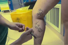 【杨柳科普】静脉曲张预防指南：5个动作+3件小事拯救你的腿图片