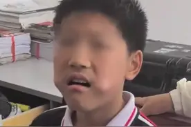 小孩哥牙龈发痒用尺子当痒痒挠被卡 网友：只有你想不到，没有他卡不了图片