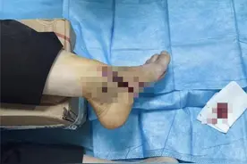 最担心的事还是发生了！资深滑板玩家挑战高难度动作骨折入院，专家提醒图片