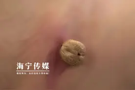 浙江女子以为是肿块，一查更吓人！这种虫子进入活跃季图片