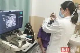 女白领头皮秃了一块原是斑秃作怪，医生：别盲目生发，诊断脱发原因很关键图片