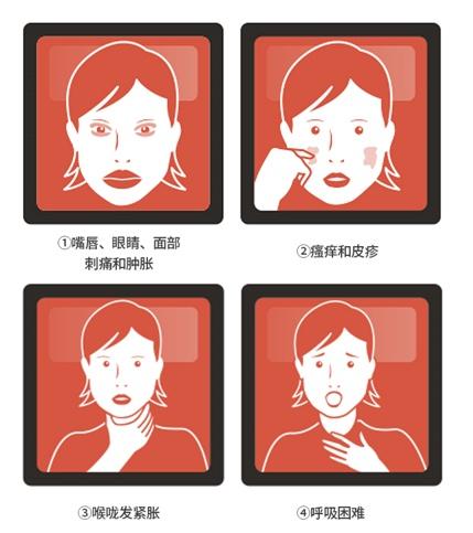 “以前不过敏，没喝酒”，协和专家吃头孢遇险！头孢还能吃吗？华山专家这样说