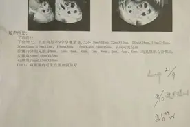 痛心！九胞胎一个都没保住……丈夫最新发声图片