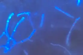 女子花重金美容却遭“毁容”！这种病最爱伪装图片