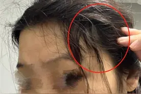 晨意帮忙丨女子一处头发被剪“秃”，接了又断咋办？理发店：已处罚，后续找理发师图片