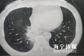 40℃！女子持续高热 医生都说少见！罪魁祸首竟在家中图片