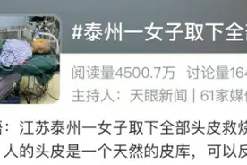 22岁女子取下全部头皮救父亲！她曾一头长发……图片