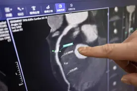 AI验血，提前“预知”疾病？颠覆想象的技术来了→图片