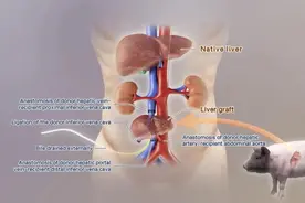 亚洲新纪录！中国基因编辑猪肾移植患者跨越100天生存关图片