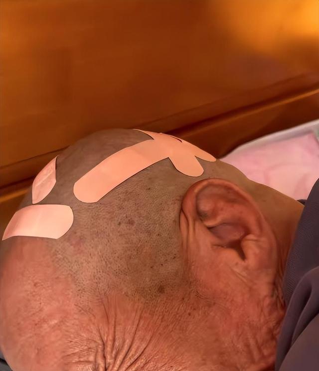 大爷花10元剃头后满头伤口不忍追责