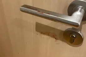网友称在昆明一民宿房间发现血迹，吓得当场离开，警方：系之前顾客意外留下图片