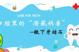 视频丨口腔里的“潜藏祸害”——龈下牙结石图片