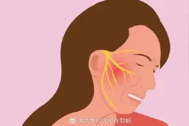 如何针对不同的面部疼痛，正确选择相应的科室？图片