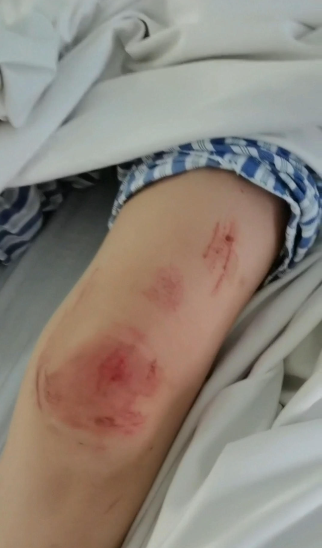 “女子遭家暴驾车逃跑致丈夫身亡案”二审将开庭，其家属坚称系正当防卫