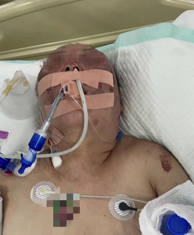 警方通报43岁女子被前夫伤害致死：犯罪嫌疑人张某铭（男，47岁）已被批准逮捕