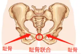 潍坊市妇幼保健院：孕产期耻骨联合疼痛难忍，怎么办？图片