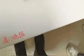 女童把橡皮泥塞鼻腔险酿祸！医生提醒→图片