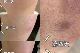 已入侵12个省份！浙江已出现，有致命危险，发现立即上报图片