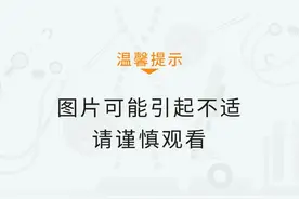 警惕！致命病菌可潜伏于生鲜，已有感染者ICU治疗！图片