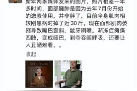 蔡磊回应面部变化：激素导致臃肿，全身肌肉减少30斤图片