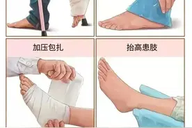 运动受伤后应该冷敷还是热敷？抽筋了如何快速缓解？很多人都做错了→图片