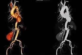 姐妹俩相继住院，病因竟藏在……图片