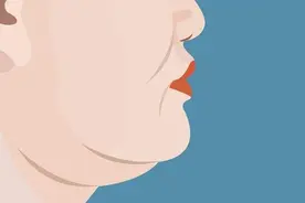 豫园社卫教你告别双下巴，守住下颌线图片