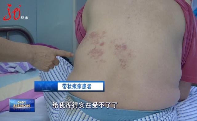 疼到彻夜难眠！这种 “蛇盘疮” 可能诱发心梗，警惕！