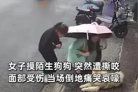 女子摸陌生狗面部惨遭撕咬：路边碰见狗好奇上前摸几下图片