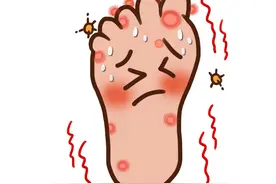 夏季这病高发，传别人，还传自己！图片