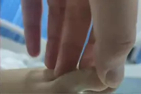 27岁女子疑被毒蛇咬伤送医身亡，在很多国家，毒蛇已经成为威胁生命的重大隐患图片