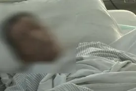 打了一声大喷嚏，阿叔被紧急送进医院！问题出在这里图片