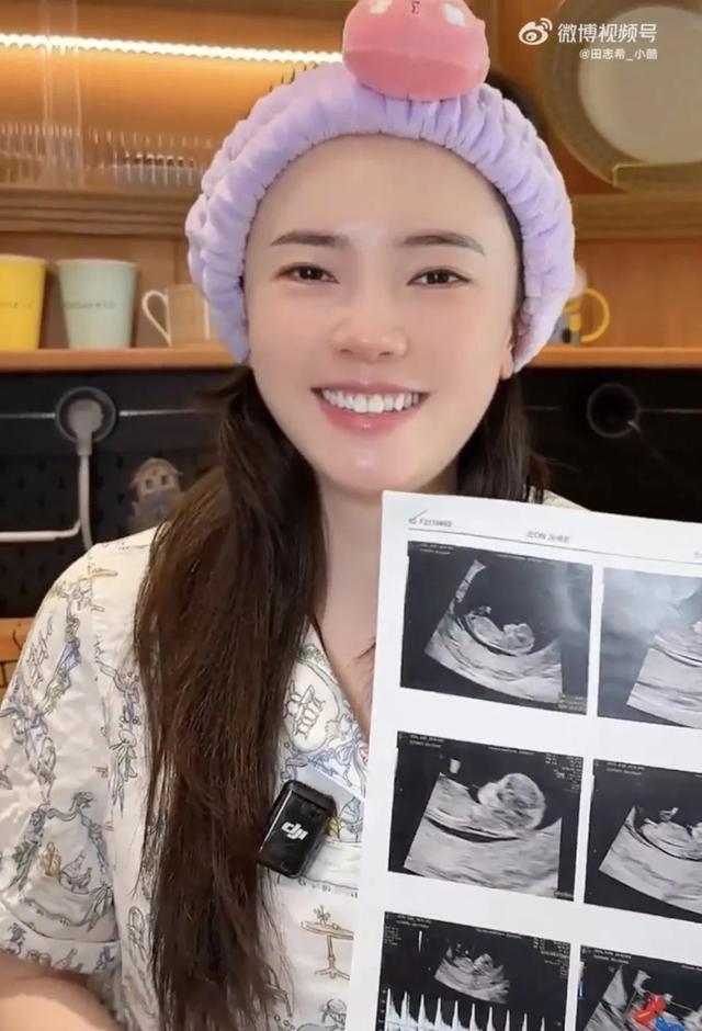 乒乓球运动员田志希宣布怀孕