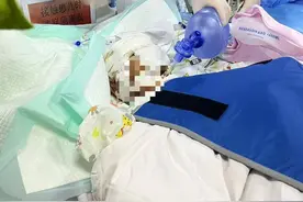 西安一4岁男童被狗咬伤住进ICU 警方：已对犬主刑事拘留｜封面深镜图片