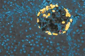 免疫系统亦参与血糖调控图片