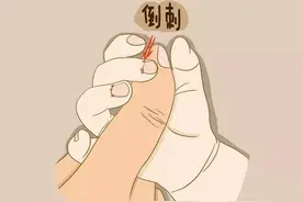 倒刺虽小，仍要注意！这些处理与预防方法学起来！图片