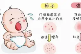 90%父母都做错的湿疹护理，记住这几点让宝宝一夜安睡图片