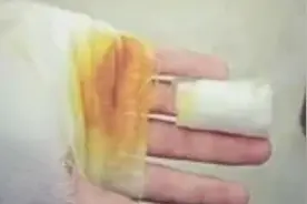 马上评｜中学生被操场地面烫伤，谁的“大课间”？图片