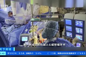 全球首例！沙特一医院完成由机器人进行的心脏移植手术图片