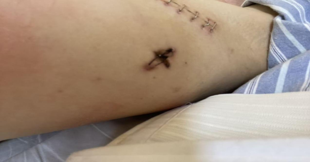 胸口仿佛被什么刺了一下	，或许那时候细菌已经住进了我的心脏