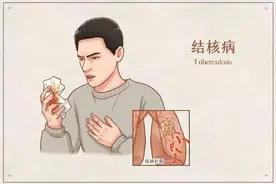 健康科普 | 结核那些事儿图片