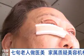 割双眼皮，祛眼袋！73岁老人买菜遇免费修眉，稀里糊涂上了手术台……图片