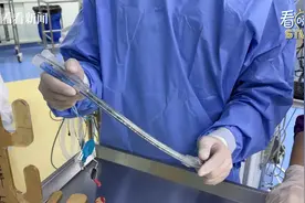 神技现世！上海中医“穴位针刺”麻醉走向全国图片