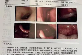 每次扁桃体发炎，血尿也会加重！医生：这种情况下切除扁桃体“更划算”图片