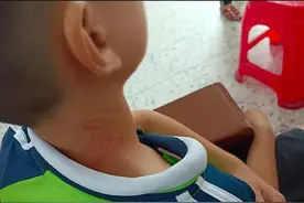 锐评|校长因学生忘戴红领巾动粗？别把停职当作处理终点图片