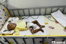 四川乐山一幼童患罕见病，父亲卖车卖房凑100多万救治近两年，孩子如今又病危图片