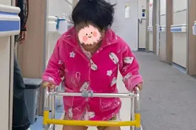 27岁“袖珍女孩”：期待自己腿变直的那刻图片