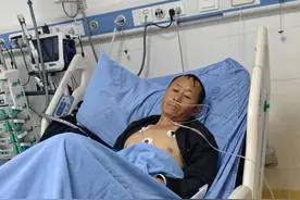 凉山一家四口误食野生菌“白罗伞”中毒住进ICU，家属求助！揭秘毒王“致命鹅膏”图片